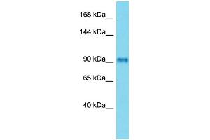 Host: Rabbit Target Name: FSIP2 Sample Type: Placenta lysates Antibody Dilution: 1. (FSIP2 antibody  (C-Term))