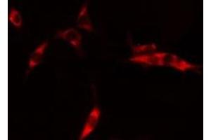 ABIN6275278 staining HepG2 cells by IF/ICC. (CYB5R3 antibody  (C-Term))