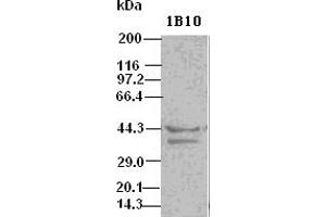 DFF45 antibody (1B10) at 1:500 dilution + Hela cell lysate (DFFA antibody  (AA 1-331))