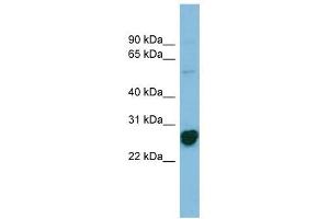 RPL10A antibody used at 1 ug/ml to detect target protein.