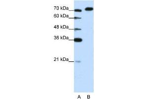 Human Jurkat; WB Suggested Anti-AKAP8L Antibody Titration: 1. (AKAP8L antibody  (C-Term))