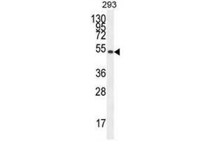 IGSF5 Antibody (N-term) western blot analysis in 293 cell line lysates (35µg/lane). (IGSF5 antibody  (N-Term))