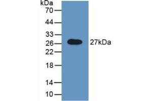 Detection of Recombinant GAS, Rat using Polyclonal Antibody to N-Acetylgalactosamine-6-Sulfatase (GALNS) (GALNS antibody  (AA 172-381))