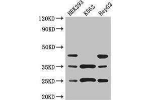 Western Blot Positive WB detected in: HEK293 whole cell lysate, K562 whole cell lysate, HepG2 whole cell lysate All lanes: PCTP antibody at 3 μg/mL Secondary Goat polyclonal to rabbit IgG at 1/50000 dilution Predicted band size: 25, 17 kDa Observed band size: 25, 35, 45 kDa (PCTP antibody  (AA 1-214))