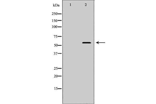 SPAM1 antibody  (Internal Region)