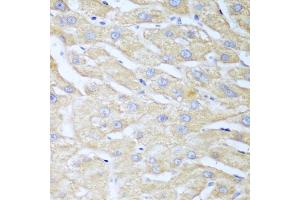 Immunohistochemistry of paraffin-embedded human liver using NUDT15 antibody. (NUDT15 antibody)