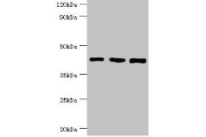 Western blot All lanes: SWI/SNF-related matrix-associated actin-dependent regulator of chromatin subfamily B member 1 antibody at 8 μg/mL Lane 1: Hela whole cell lysate Lane 2: 293T whole cell lysate Lane 3: Mouse stomach tissue Secondary Goat polyclonal to rabbit IgG at 1/10000 dilution Predicted band size: 45, 44 kDa Observed band size: 45 kDa (SMARCB1 antibody  (AA 86-385))
