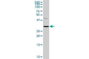 PITX1 MaxPab rabbit polyclonal antibody. (PITX1 antibody  (AA 1-314))