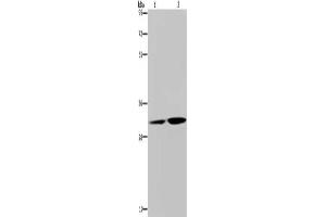 Gel: 8 % SDS-PAGE, Lysate: 40 μg, Lane 1-2: HT29 cells, human placenta tissue, Primary antibody: ABIN7129237(DNASE1L3 Antibody) at dilution 1/450, Secondary antibody: Goat anti rabbit IgG at 1/8000 dilution, Exposure time: 30 seconds (DNASE1L3 antibody)