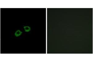 Immunofluorescence analysis of A549 cells, using ARFGEF2 Antibody. (ARFGEF2 antibody  (AA 1491-1540))