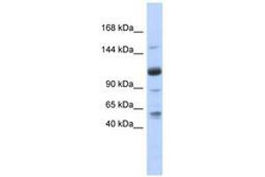 Image no. 1 for anti-U2-Associated SR140 Protein (SR140) (AA 71-120) antibody (ABIN6740719) (SR140 antibody  (AA 71-120))