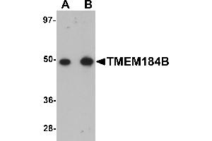 Western Blotting (WB) image for anti-Transmembrane Protein 184B (TMEM184B) (C-Term) antibody (ABIN1030751) (TMEM184B antibody  (C-Term))