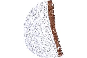 Urothelium with intense cytoplasmic and nuclear MTAP staining of all epithelial cells