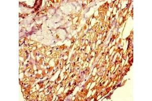Immunohistochemistry of paraffin-embedded human thyroid tissue using ABIN7160766 at dilution of 1:100 (SETD8 antibody  (AA 136-258))