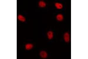 ABIN6267046 staining HepG2 by IF/ICC. (H1FOO antibody  (Internal Region))