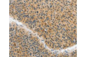 Immunohistochemistry (IHC) image for anti-ATP Citrate Lyase (ACLY) antibody (ABIN2422964) (ACLY antibody)