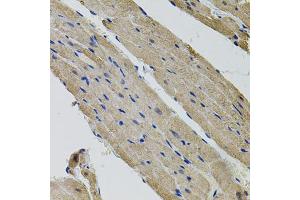 Immunohistochemistry of paraffin-embedded rat heart using ALDH9A1 antibody (ABIN5995392) (40x lens).