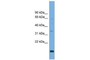 Western Blot showing SLC25A44 antibody used at a concentration of 1-2 ug/ml to detect its target protein.