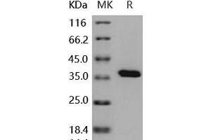 Western Blotting (WB) image for Protein tyrosine Phosphatase, Non-Receptor Type 1 (PTPN1) (Active) protein (His tag) (ABIN7317110) (PTPN1 Protein (His tag))