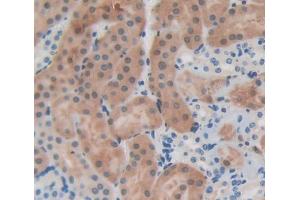 Used in DAB staining on fromalin fixed paraffin- embedded kidney tissue (EPB41 antibody  (AA 211-498))