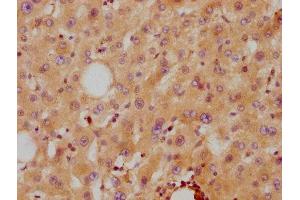 IHC image of ABIN7127342 diluted at 1:87. (Recombinant APOA2 antibody)