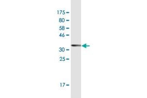 PPP1R10 antibody  (AA 1-83)