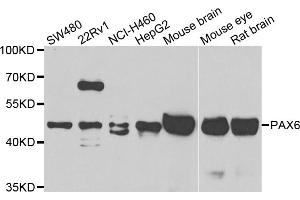 Western blot analysis of extracts of various cell lines, using PAX6 antibody. (PAX6 antibody)