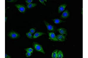 Immunofluorescent analysis of A549 cells using ABIN7149920 at dilution of 1:100 and Alexa Fluor 488-congugated AffiniPure Goat Anti-Rabbit IgG(H+L) (QDPR antibody  (AA 2-244))