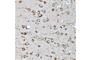 Immunohistochemistry of paraffin-embedded rat brain using Phospho-KRAS-S89 Rabbit pAb (ABIN7267530) at dilution of 1:100 (40x lens). (K-RAS antibody  (pSer89))