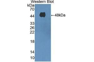 Figure. (ADCY8 antibody  (AA 234-371))