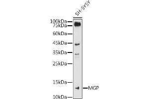 Western blot analysis of extracts of SH-SY5Y cells, using MGP antibody (ABIN6128268, ABIN6143825, ABIN6143826 and ABIN6221090) at 1:1000 dilution. (MGP antibody  (AA 20-103))