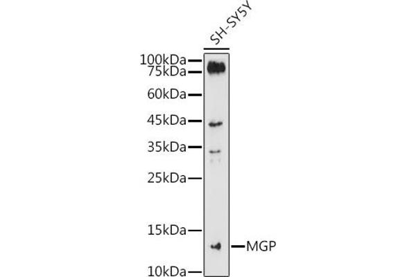 MGP antibody  (AA 20-103)