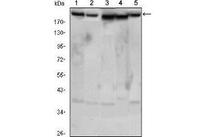 Western blot analysis using RICTOR mouse mAb against Hela (1), PANC-1 (2), MOLT4 (3), HepG2 (4) and HEK293 (5) cell lysate. (RICTOR antibody)