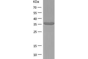 Western Blotting (WB) image for Zinc Binding Alcohol Dehydrogenase Domain Containing 2 (ZADH2) (AA 33-377) protein (His tag) (ABIN7287922) (ZADH2 Protein (AA 33-377) (His tag))