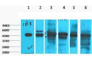 Western Blot (WB) analysis of 1) HepG2, 2) HeLa, 3) Mouse Liver tissue, 4) C2C12, 5) Rat Heart tissue, 6) Mouse Skeletal Muscle tissue, diluted at 1:2000. (Cytokeratin 18 antibody)