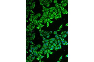 Immunofluorescence analysis of MCF-7 cells using DAP antibody (ABIN5973626).
