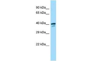 Western Blotting (WB) image for anti-Spermine Synthase, SMS (SMS) (Middle Region) antibody (ABIN2789346) (SMS antibody  (Middle Region))