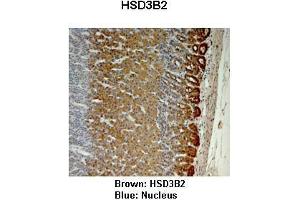 Sample Type :  Monkey adrenal gland   Primary Antibody Dilution :   1:25   Secondary Antibody:  Anti-rabbit-HRP   Secondary Antibody Dilution:   1:1000   Color/Signal Descriptions:  Brown: HSD3B2 Blue: Nucleus   Gene Name:  HSD3B2   Submitted by:  Jonathan Bertin, Endoceutics Inc. (HSD3B2 antibody  (N-Term))