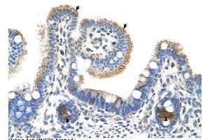 RNF39 antibody was used for immunohistochemistry at a concentration of 4-8 ug/ml to stain Epithelial cells of intestinal villus (arrows) and intestinal gland (arrows Heads) in Human Intestine. (RNF39 antibody  (N-Term))