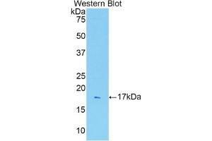 Detection of Recombinant IL1R1, Rat using Polyclonal Antibody to Interleukin 1 Receptor Type I (IL1R1) (IL1R1 antibody  (AA 226-352))