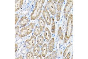 Immunohistochemistry of paraffin-embedded mouse kidney using THUMPD3 Rabbit pAb (ABIN6132951, ABIN6149133, ABIN6149134 and ABIN6214652) at dilution of 1:200 (40x lens).