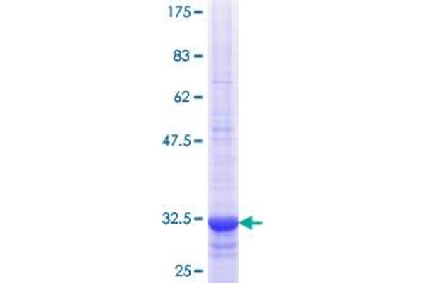 SLC22A8 Protein (AA 256-325) (GST tag)