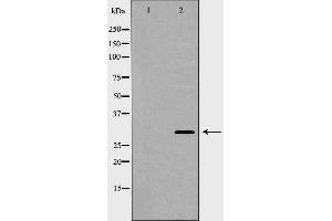 Western blot analysis of extracts of Hela , using KLK1 antibody. (Kallikrein 1 antibody  (Internal Region))