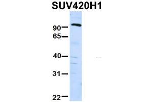 Host:  Rabbit  Target Name:  FAM46C  Sample Type:  Human Fetal Liver  Antibody Dilution:  1. (SUV420H1 antibody  (Middle Region))