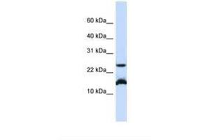Image no. 1 for anti-Basic Leucine Zipper ATF-like Transcription Factor (BATF) (N-Term) antibody (ABIN6737853) (BATF antibody  (N-Term))