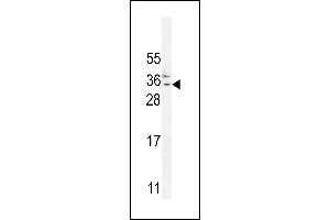 C Antibody (N-term) (ABIN654735 and ABIN2844423) western blot analysis in MDA-M cell line lysates (35 μg/lane). (C11orf73 antibody  (N-Term))