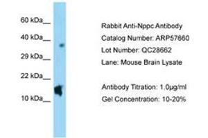 Image no. 1 for anti-Natriuretic Peptide Type C (NPPC) (AA 71-120) antibody (ABIN6749943) (NPPC antibody  (AA 71-120))