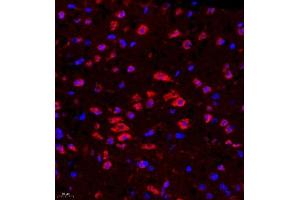 Immunofluorescence of paraffin embedded mouse brain using Rac3 (ABIN7075378) at dilution of 1:500 (400x lens) (RAC3 antibody)