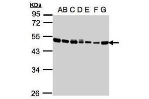 WB Image Sample(30μg whole cell lysate) A: 293T B: A431 , C: H1299 D: HeLa S3 , E: Hep G2 , F: MOLT4 , G: Raji , 10% SDS PAGE antibody diluted at 1:1000 (EEF1A2 antibody)