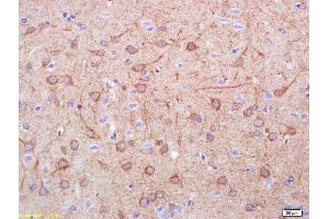 Formalin-fixed and paraffin embedded rat brain labeled with Rabbit Anti DDC/DOPA Decarboxylase Polyclonal Antibody, Unconjugated (ABIN725945) at 1:200 followed by conjugation to the secondary antibody and DAB staining (DDC antibody  (AA 201-300))